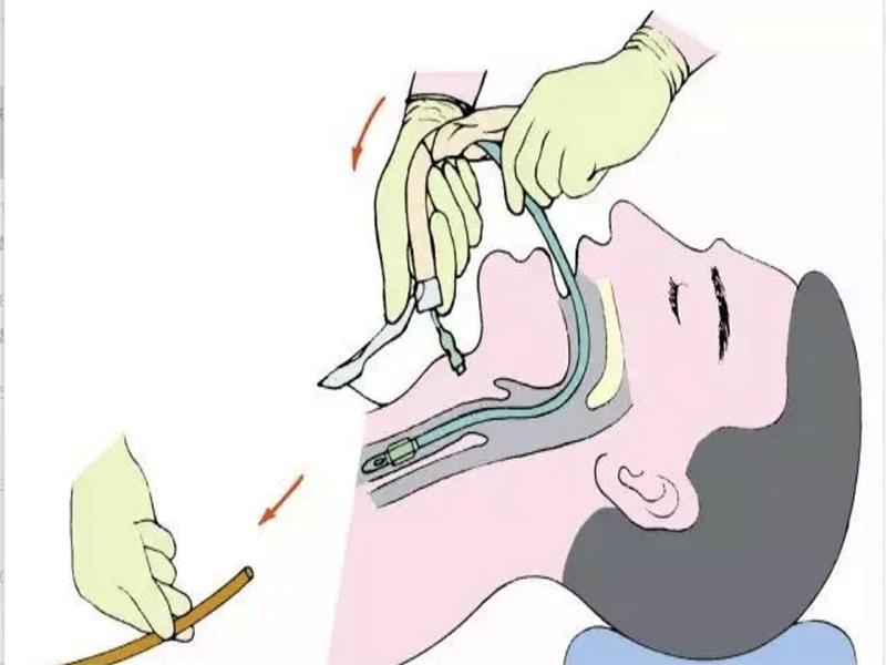 الموافقة المسبقة عن علم، 2